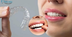 Niềng răng thẩm mỹ - giải pháp mang đến nụ cười đẹp cho mọi lứa tuổi